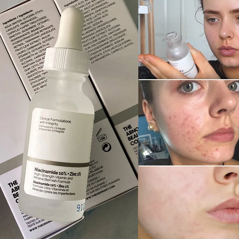 The Ordinary Niacinamide 10%   Zinc 1% (30ml) | Sérum Vitamina B3